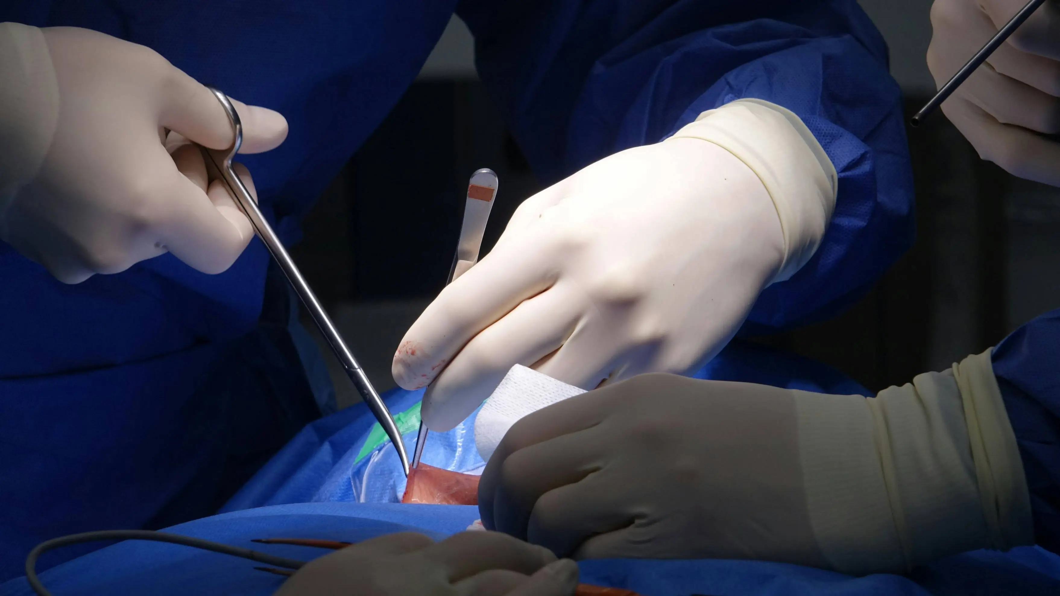 Surgery Complications