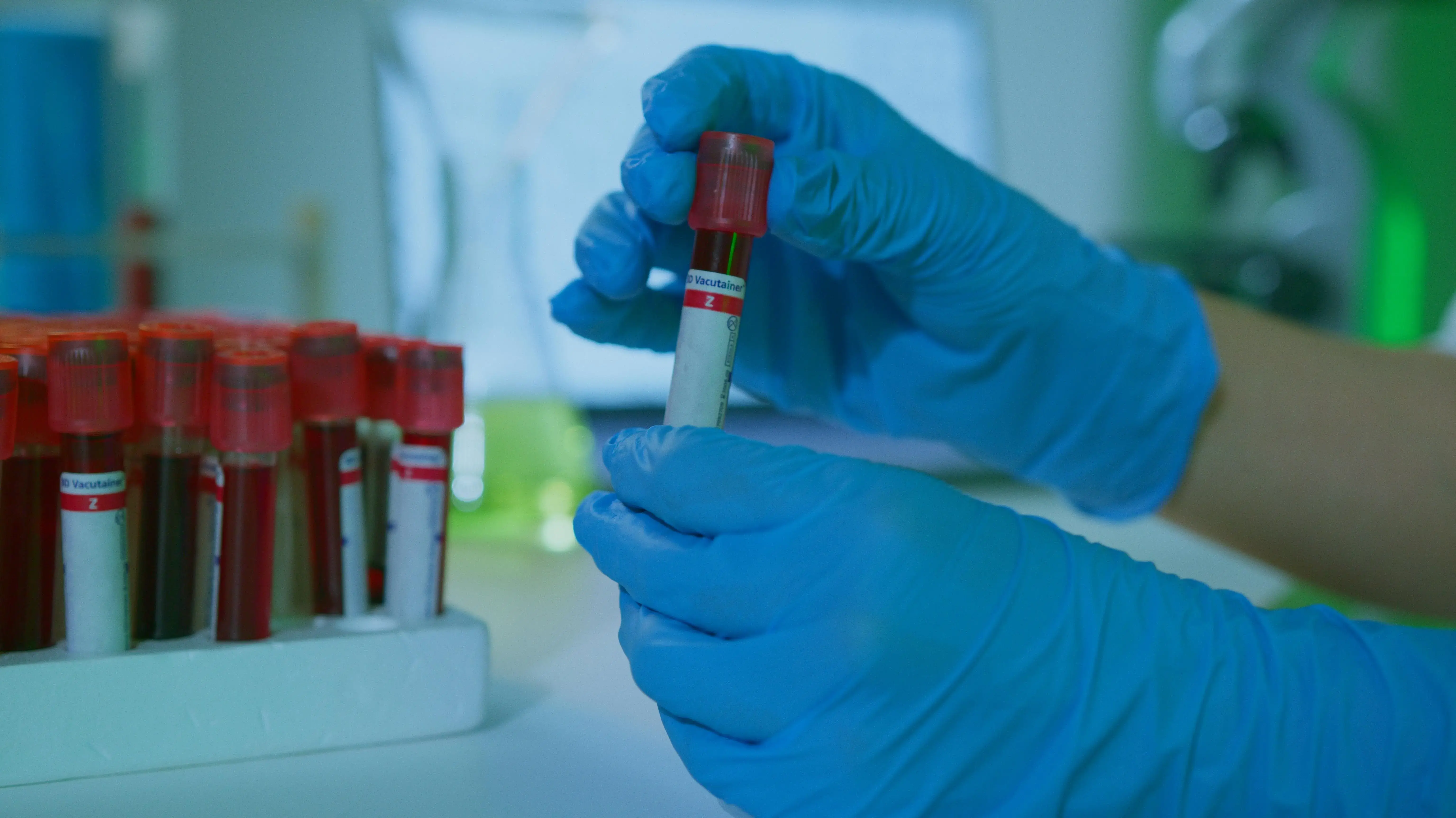 Diagnostic lab near me Gani Hospitals lab blood sample pickup Ramnad lab test at home
