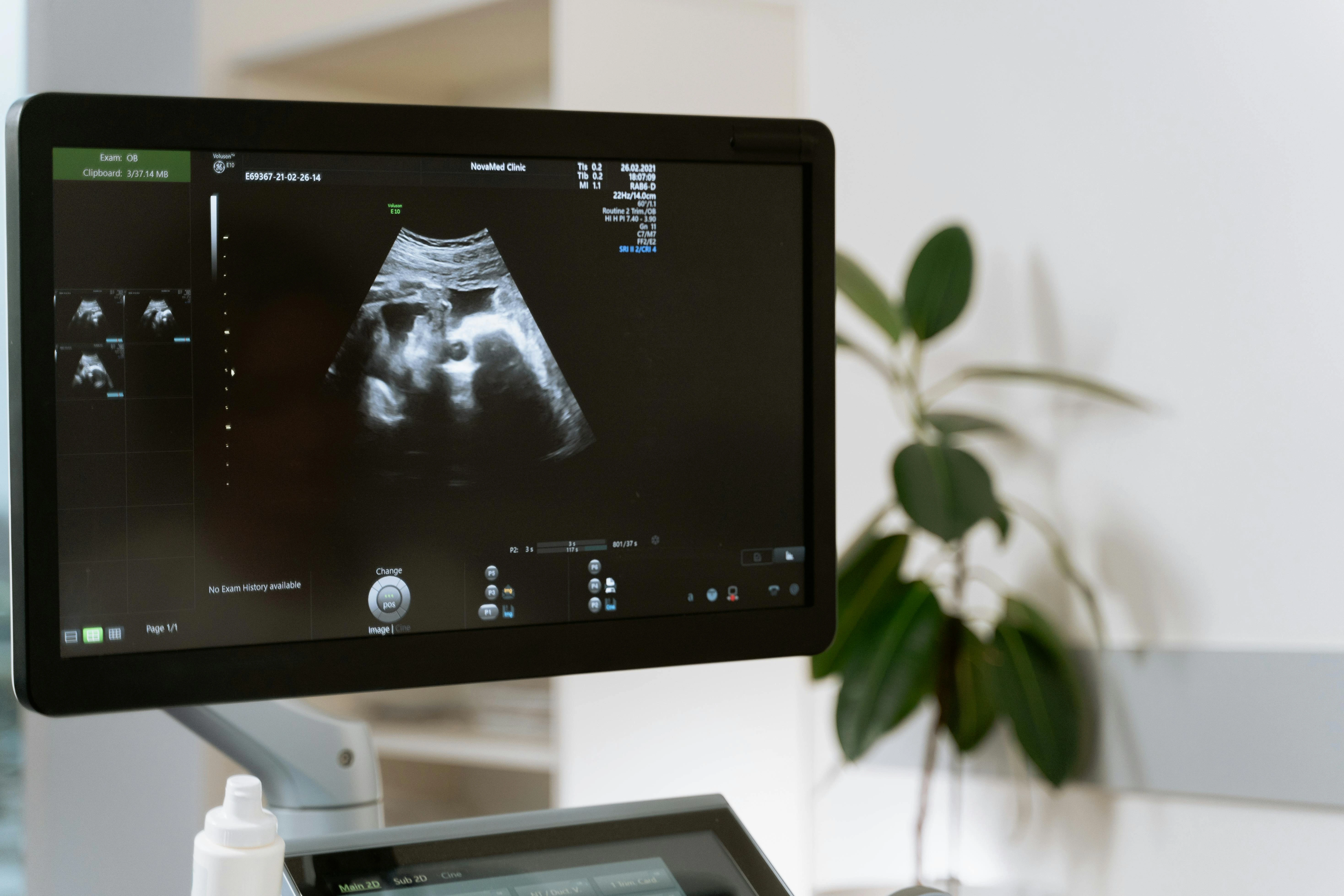 Pregnancy scan Ramanathapuram - Ultrasound at Gani Hospitals